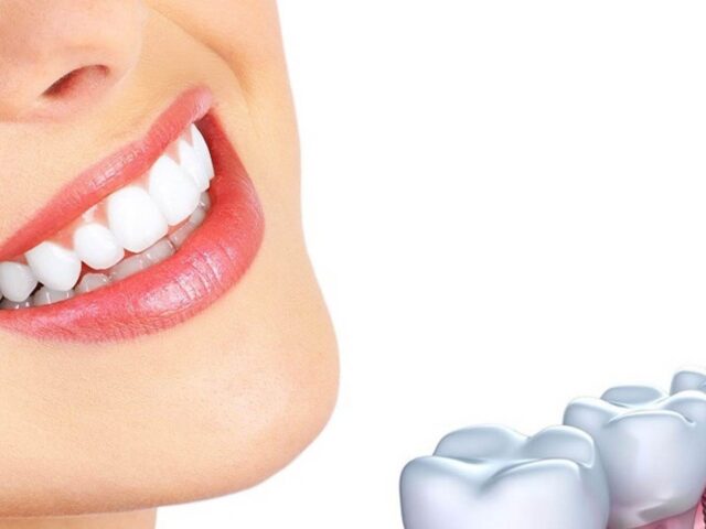 أنواع زراعة الأسنان واسعارها